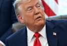 BREAKING: Trump Chronic Venous Insufficiency Diagnosis Confirmed